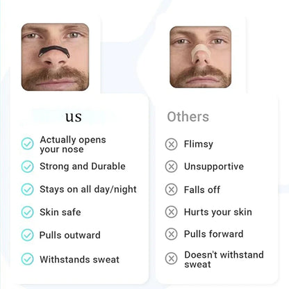 AirFlow™ Nasal Strips